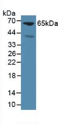 Polyclonal Antibody to Glypican 3 (GPC3)