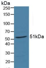 Polyclonal Antibody to Retinoic Acid Receptor Alpha (RARa)