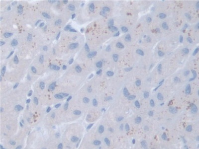 Polyclonal Antibody to Retinoic Acid Receptor Alpha (RARa)