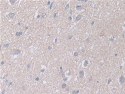 Polyclonal Antibody to Retinoic Acid Receptor Alpha (RARa)