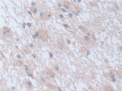 Polyclonal Antibody to Retinoic Acid Receptor Alpha (RARa)