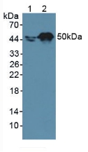 Polyclonal Antibody to Retinoic Acid Receptor Alpha (RARa)