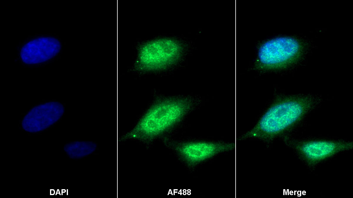 Polyclonal Antibody to Retinoic Acid Receptor Alpha (RARa)