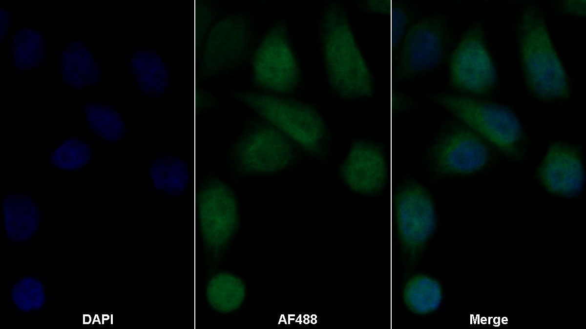 Polyclonal Antibody to Retinoic Acid Receptor Alpha (RARa)