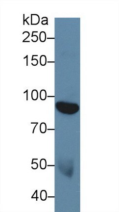 Polyclonal Antibody to Discoidin Domain Receptor Family, Member 1 (DDR1)