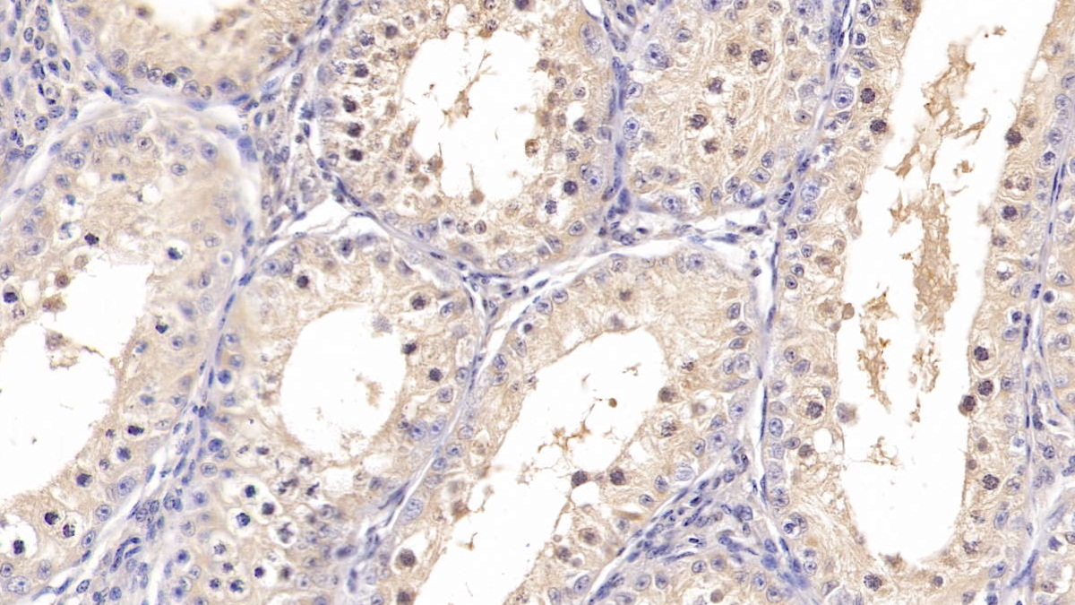 Polyclonal Antibody to Cyclophilin A (CYPA)