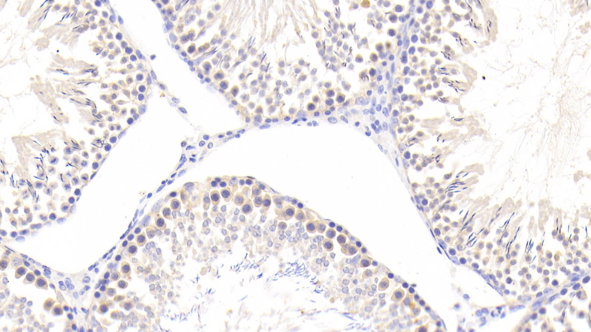 Polyclonal Antibody to Cyclophilin A (CYPA)