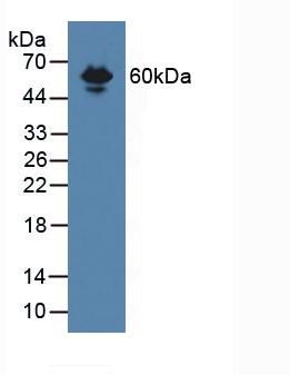 Polyclonal Antibody to Endoglin (ENG)