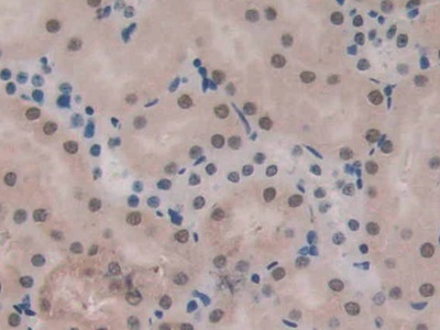 Polyclonal Antibody to Endoglin (ENG)