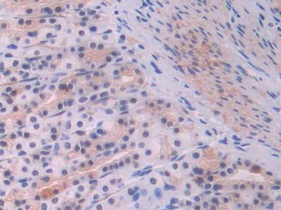 Polyclonal Antibody to Endoglin (ENG)