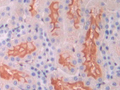 Polyclonal Antibody to Endoglin (ENG)