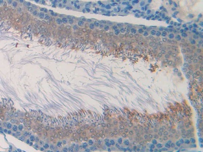 Polyclonal Antibody to Cholinergic Receptor, Muscarinic 1 (CHRM1)