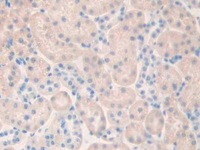 Polyclonal Antibody to Cholinergic Receptor, Muscarinic 1 (CHRM1)