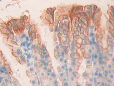 Polyclonal Antibody to Cholinergic Receptor, Muscarinic 1 (CHRM1)