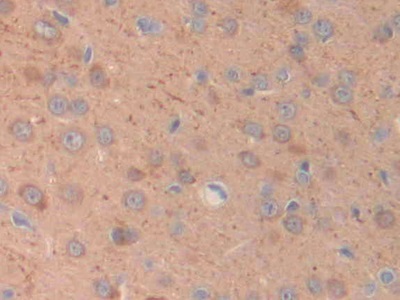 Polyclonal Antibody to Cholinergic Receptor, Muscarinic 1 (CHRM1)