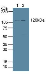 Polyclonal Antibody to Protein Tyrosine Phosphatase Receptor Type H (PTPRH)