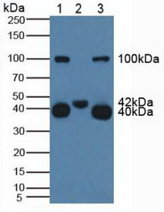 Polyclonal Antibody to Cluster Of Differentiation 161 (CD161)