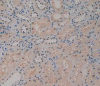 Polyclonal Antibody to Cluster Of Differentiation 161 (CD161)