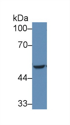 Polyclonal Antibody to Cytochrome P450 2E1 (CYP2E1)