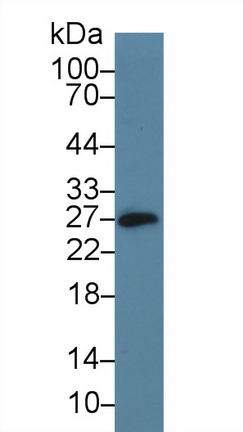 Polyclonal Antibody to Cluster Of Differentiation 160 (CD160)