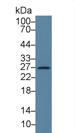 Polyclonal Antibody to Cluster Of Differentiation 160 (CD160)