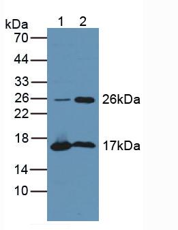 Polyclonal Antibody to Tubulin Polymerization Promoting Protein (TPPP)