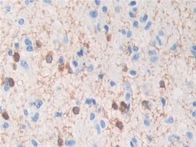 Polyclonal Antibody to Tubulin Polymerization Promoting Protein (TPPP)