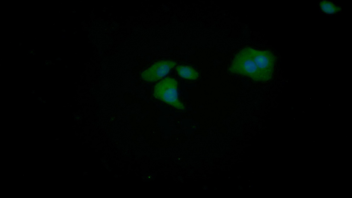 Polyclonal Antibody to Tubulin Polymerization Promoting Protein (TPPP)