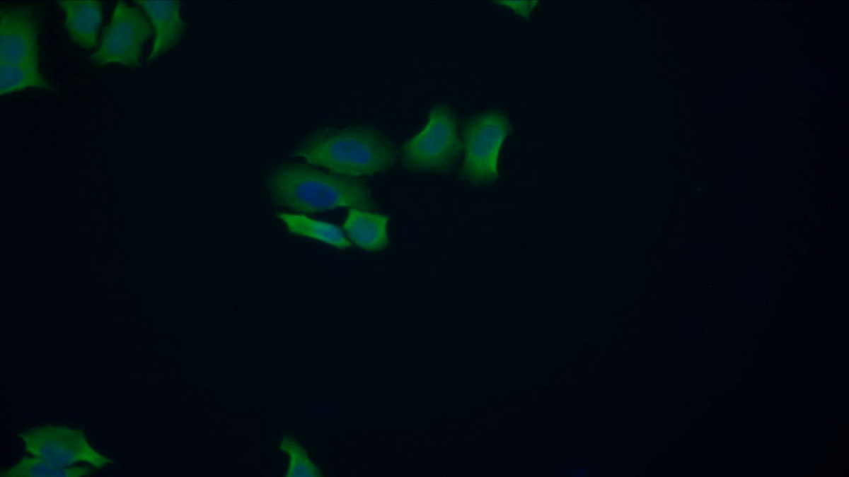 Polyclonal Antibody to Acid Phosphatase 1 (ACP1)