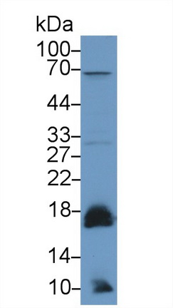 Polyclonal Antibody to Acid Phosphatase 1 (ACP1)