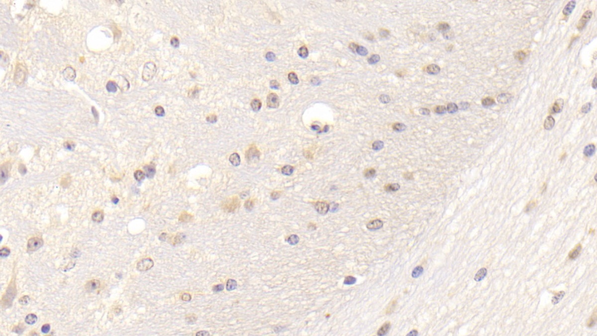 Polyclonal Antibody to Low Density Lipoprotein Receptor (LDLR)