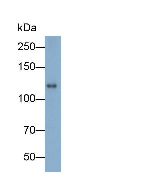 Polyclonal Antibody to Placental Cadherin (P-cadherin)