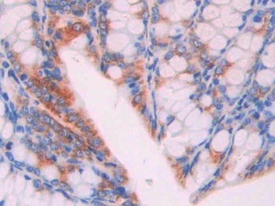 Polyclonal Antibody to Integrin Associated Protein (IAP)