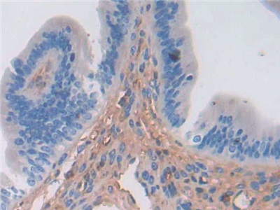 Polyclonal Antibody to Alpha-1-Antichymotrypsin (a1ACT)