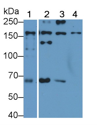 Polyclonal Antibody to Alpha-2-Macroglobulin (a2M)