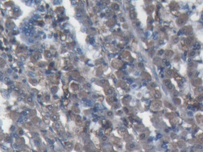 Polyclonal Antibody to Alpha-2-Macroglobulin (a2M)