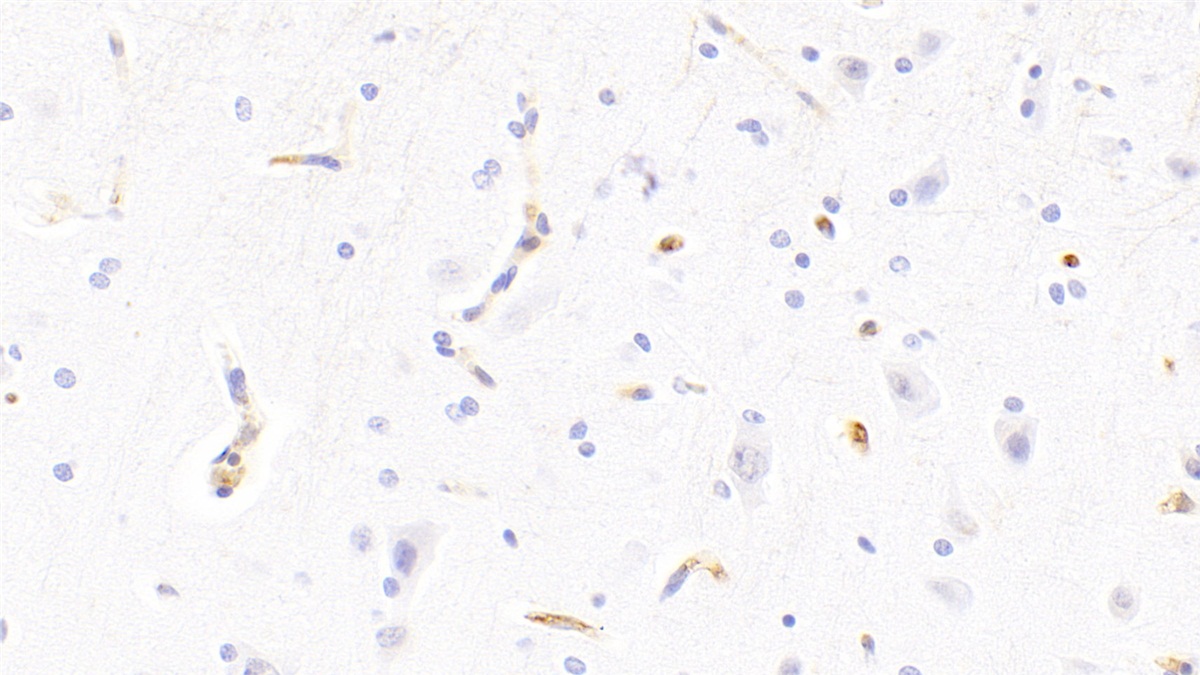 Polyclonal Antibody to Alpha-2-Macroglobulin (a2M)