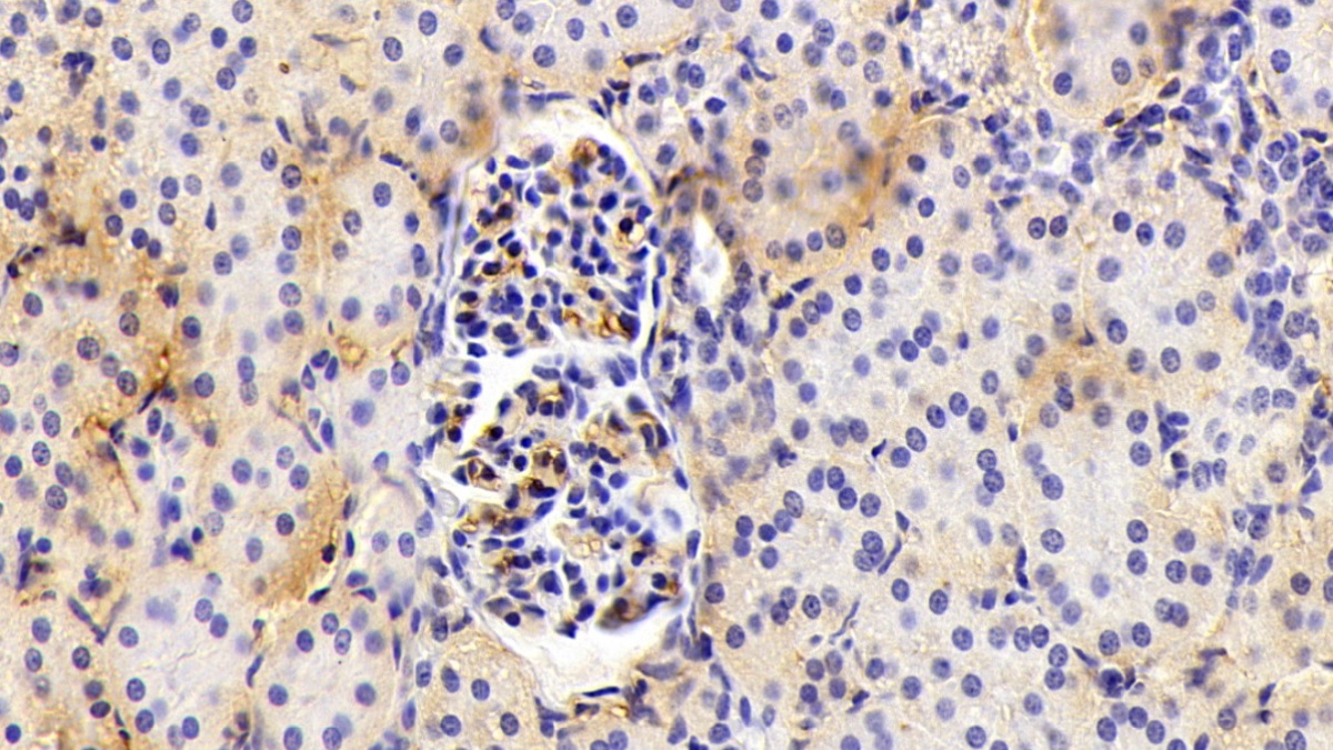 Polyclonal Antibody to Alpha-2-Macroglobulin (a2M)