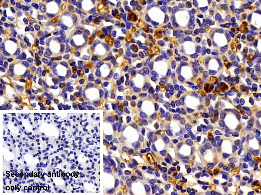 Polyclonal Antibody to Alpha-2-Macroglobulin (a2M)