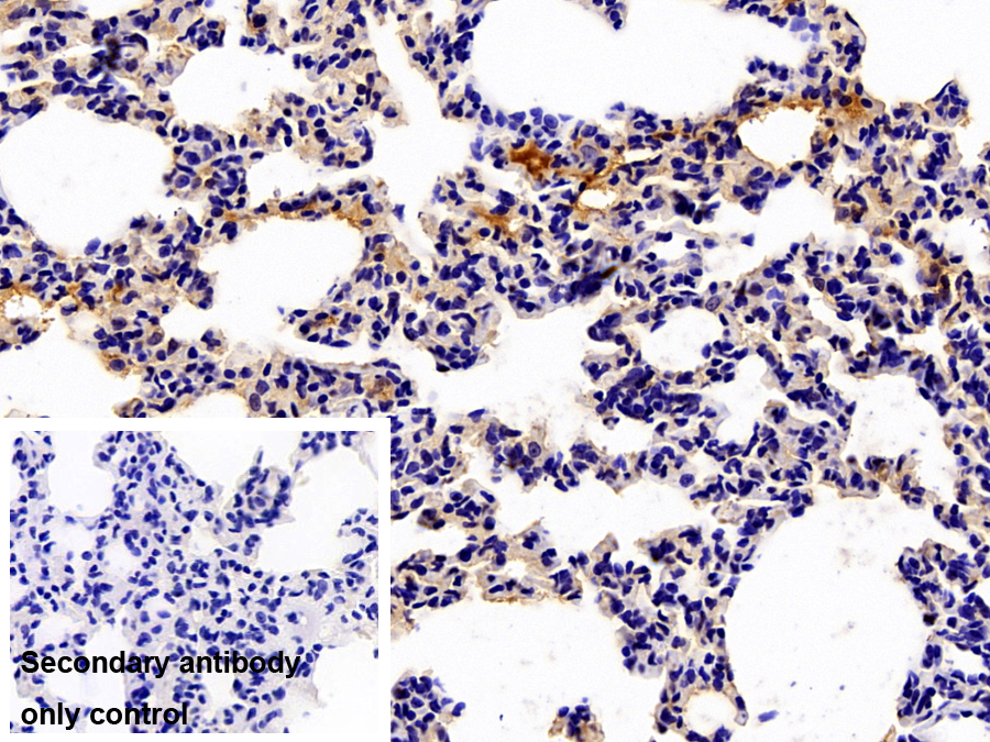 Polyclonal Antibody to Alpha-2-Macroglobulin (a2M)