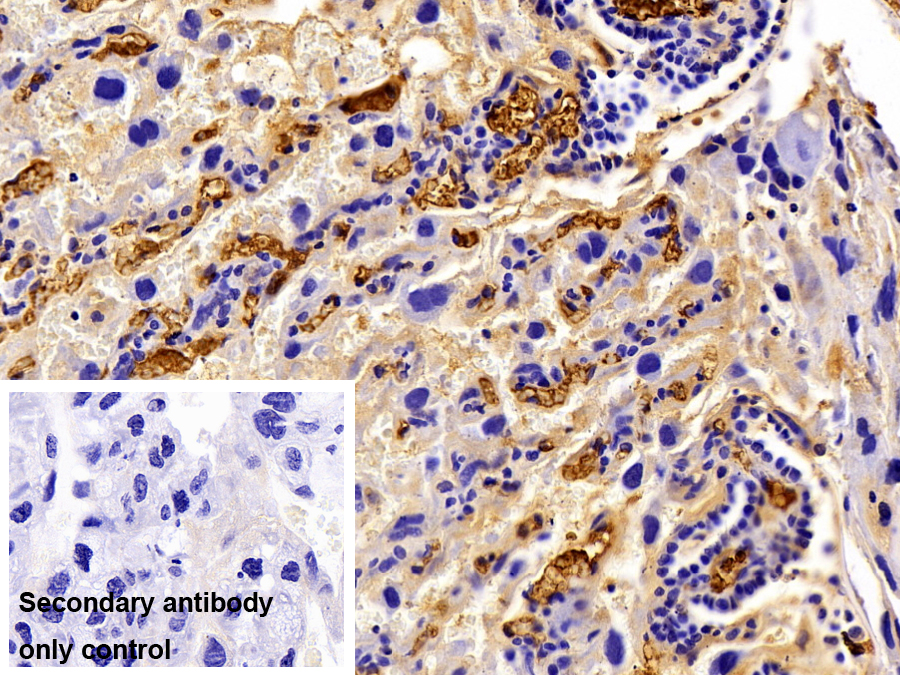 Polyclonal Antibody to Alpha-2-Macroglobulin (a2M)