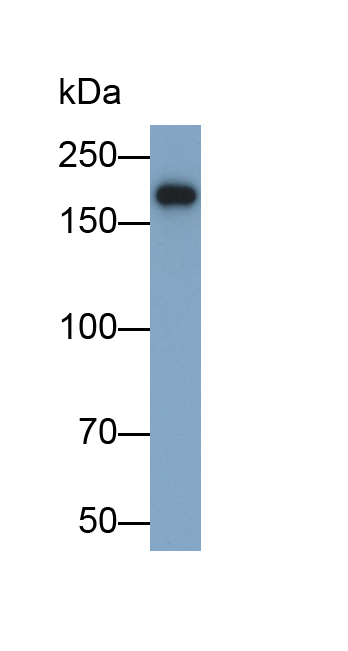 Polyclonal Antibody to Alpha-2-Macroglobulin (a2M)