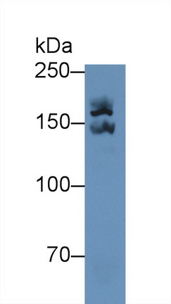 Polyclonal Antibody to Alpha-2-Macroglobulin (a2M)