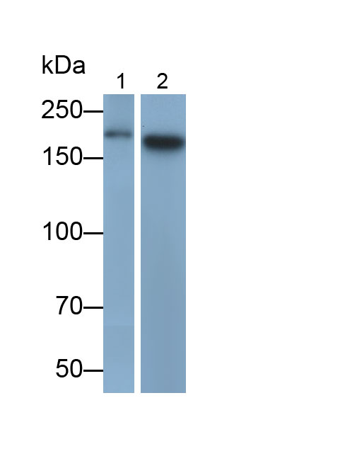 Polyclonal Antibody to Alpha-2-Macroglobulin (a2M)