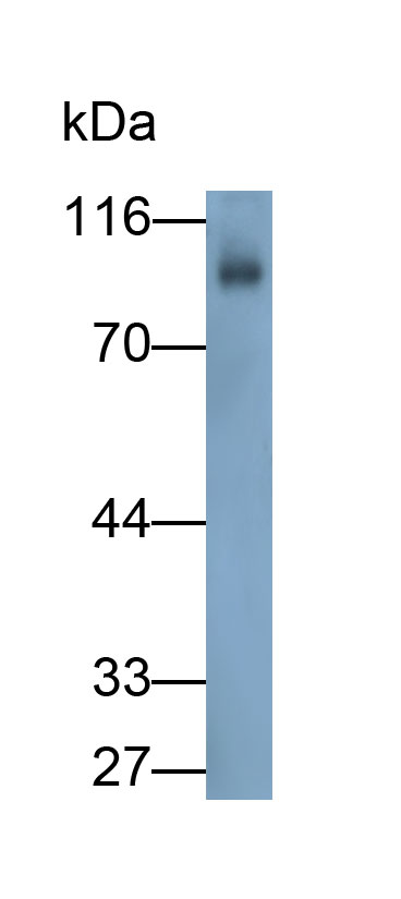 Polyclonal Antibody to Amyloid Precursor Protein (APP)