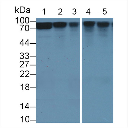 Polyclonal Antibody to Beta Catenin (β-catenin)