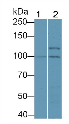 Polyclonal Antibody to Beta Catenin (β-catenin)