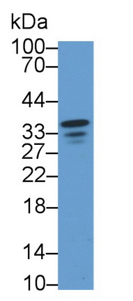 Polyclonal Antibody to Neuromedin U (NMU)