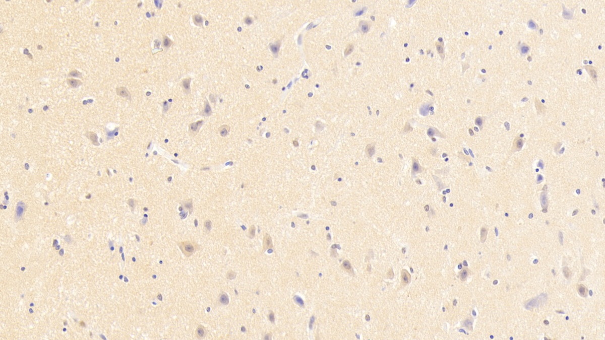 Polyclonal Antibody to Neuromedin U (NMU)