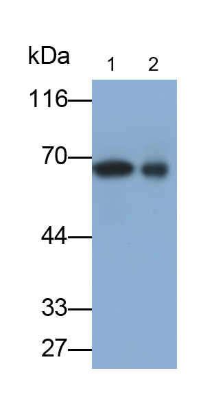 Polyclonal Antibody to Albumin (ALB)